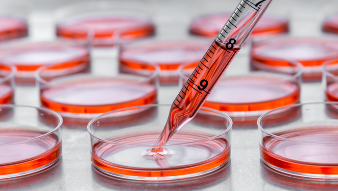 Is Plasmid DNA Quality Affecting your Transfections?
